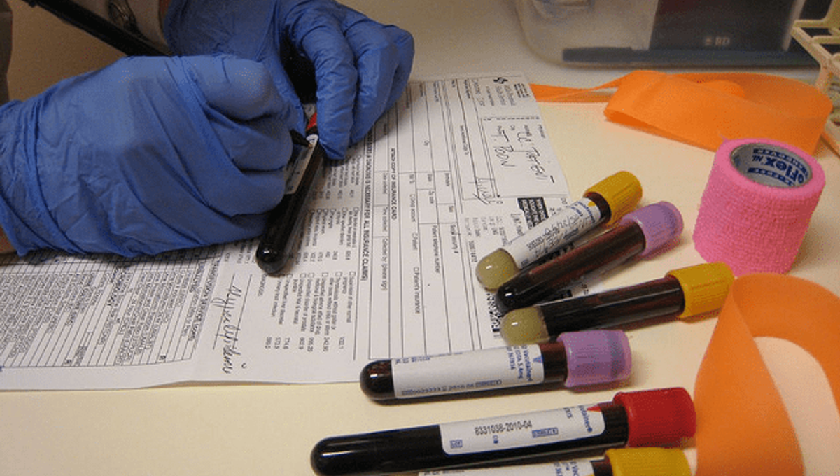 யாழில்,மர்மமாக உயிரிழந்த சிறுவன்