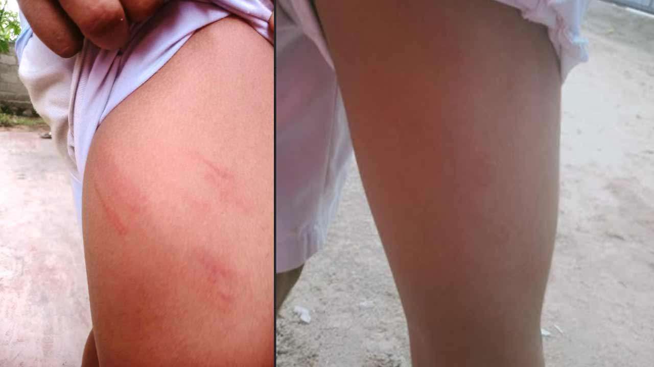 அம்பாறை பாடசாலை ஒன்றில் மாணவர்களை கொடூரமாக தாக்கிய அதிபர்