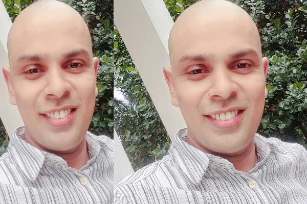 மொட்டியடித்த அர்ச்சுனா எம்.பி!